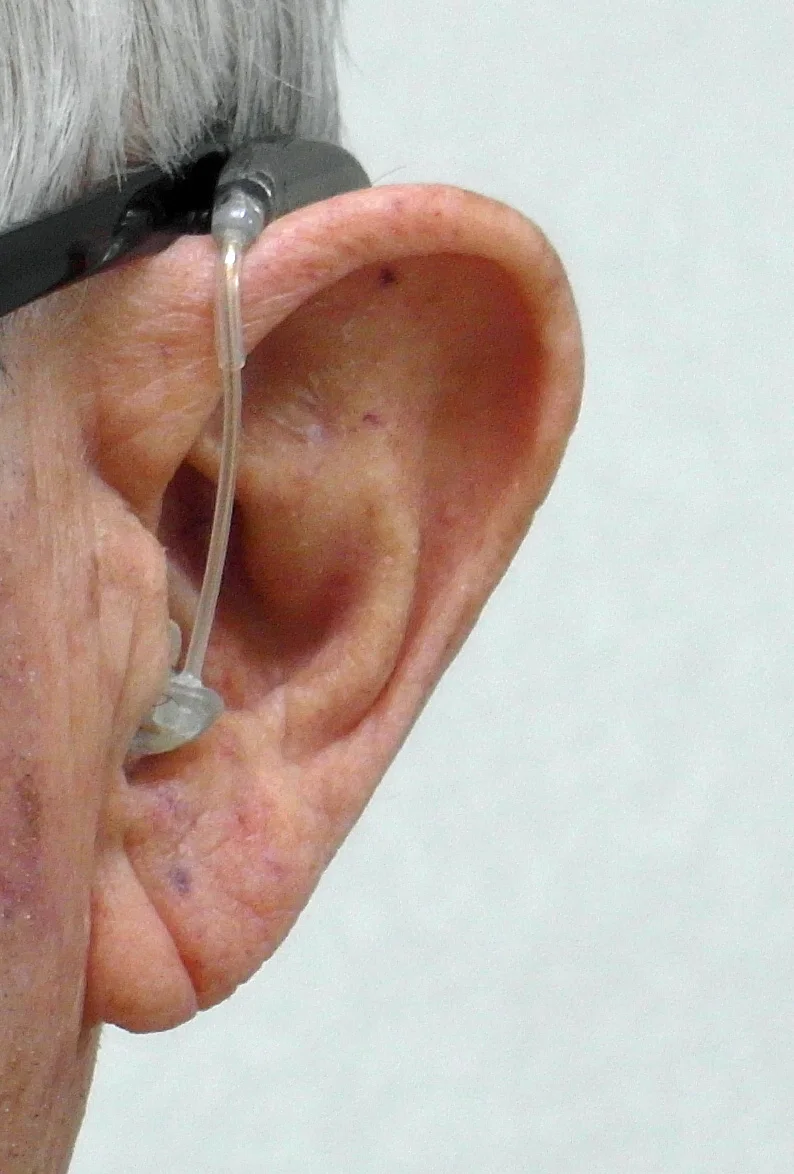 Ear%202