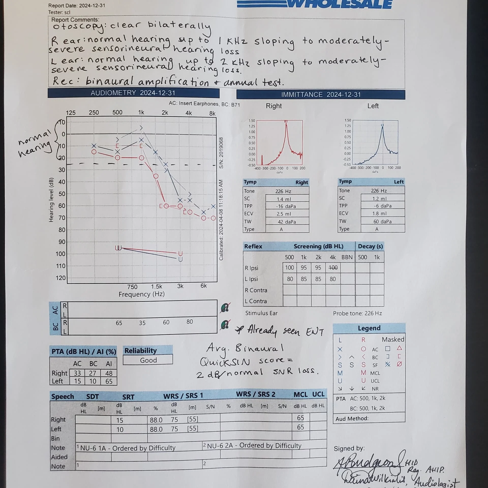 Audiogram - Costco Dec 2024