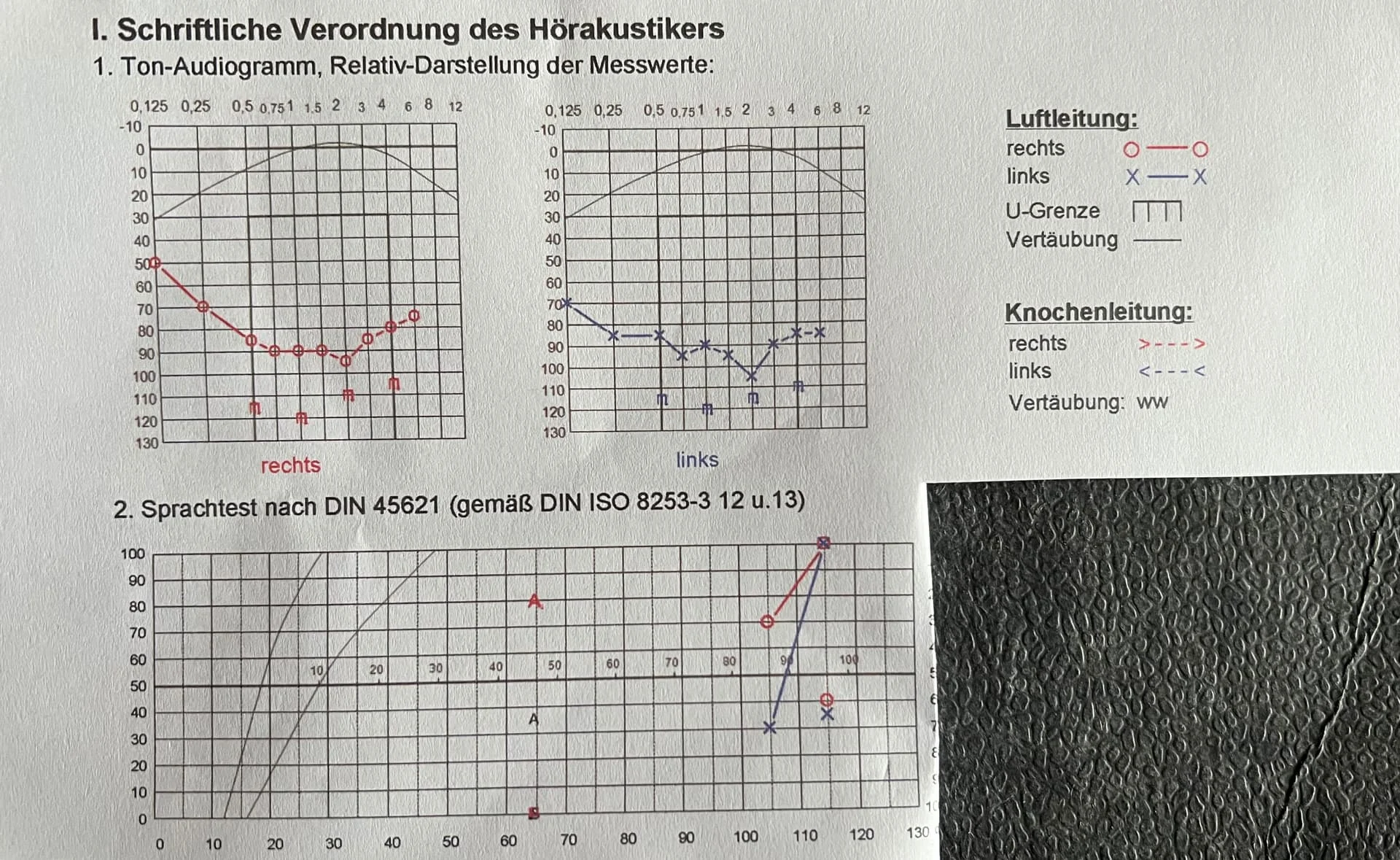 Hördiagramm
