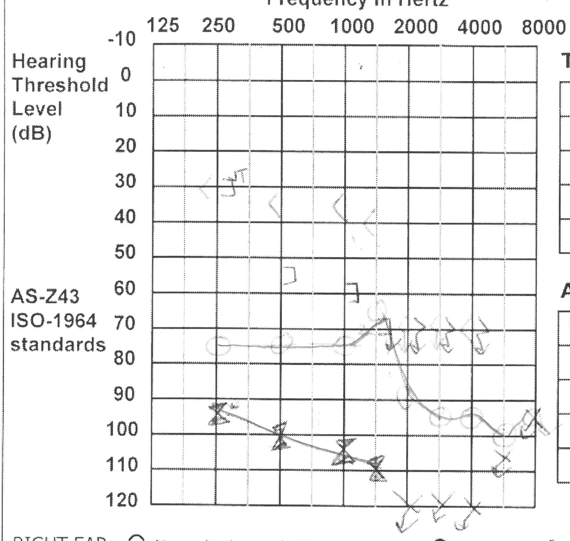 Audiogram (23-Feb-2012)