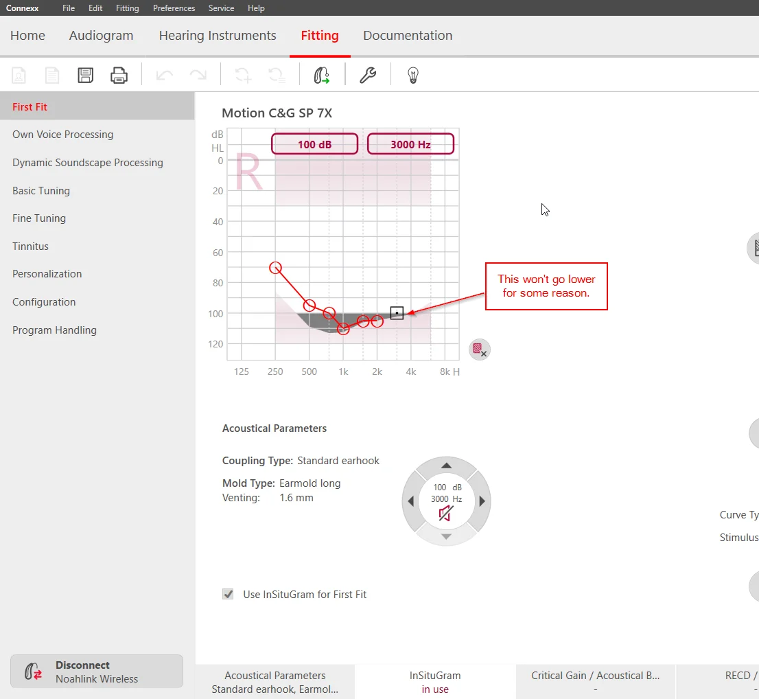 audiogram setting