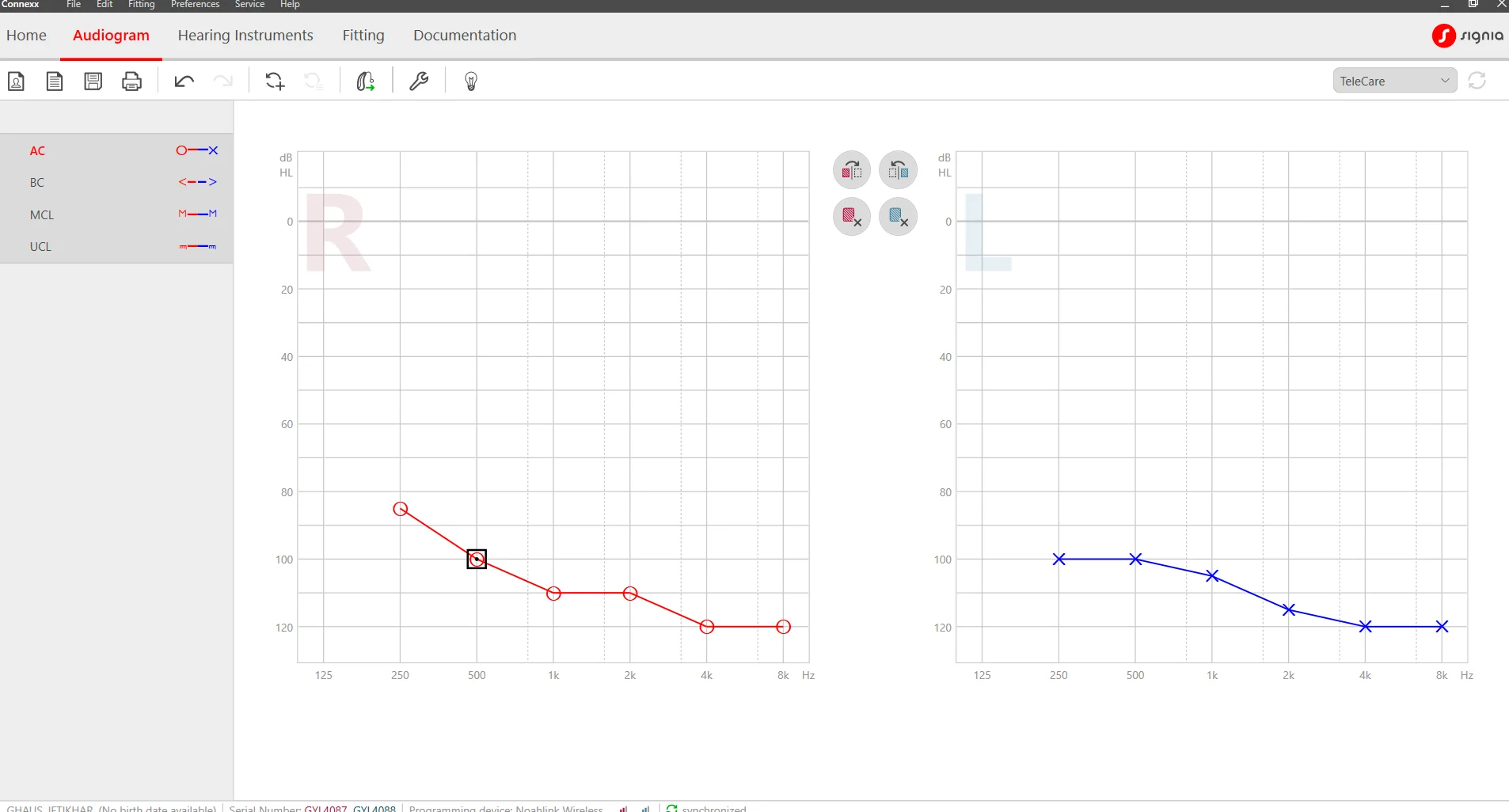 Final audiogram with clear performance