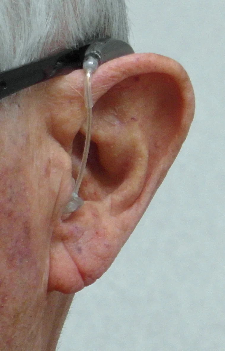 Ear1