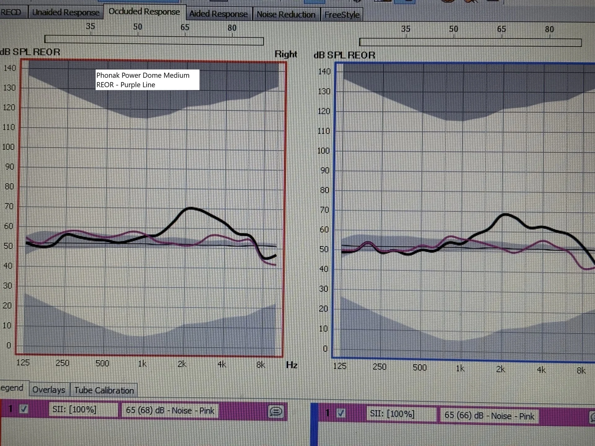 _REOR-Phonak Power Medium