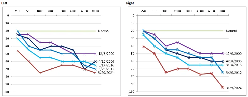 Audiogram Compare - all