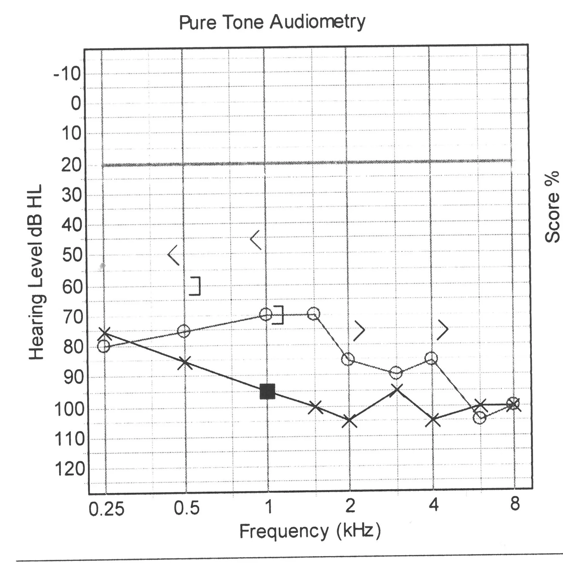 Audiogram (06-July-2012)