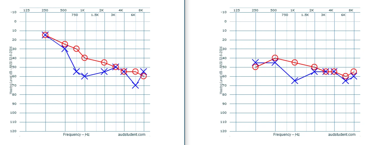 Audiogram%20Comparison