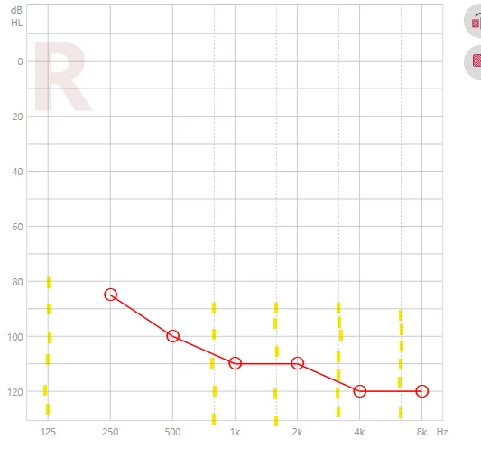 charge & go audiogram-1