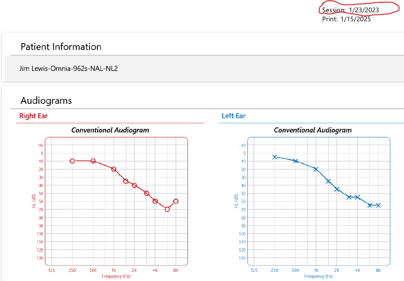 20250115 Smart Fit Report Shows Session Date