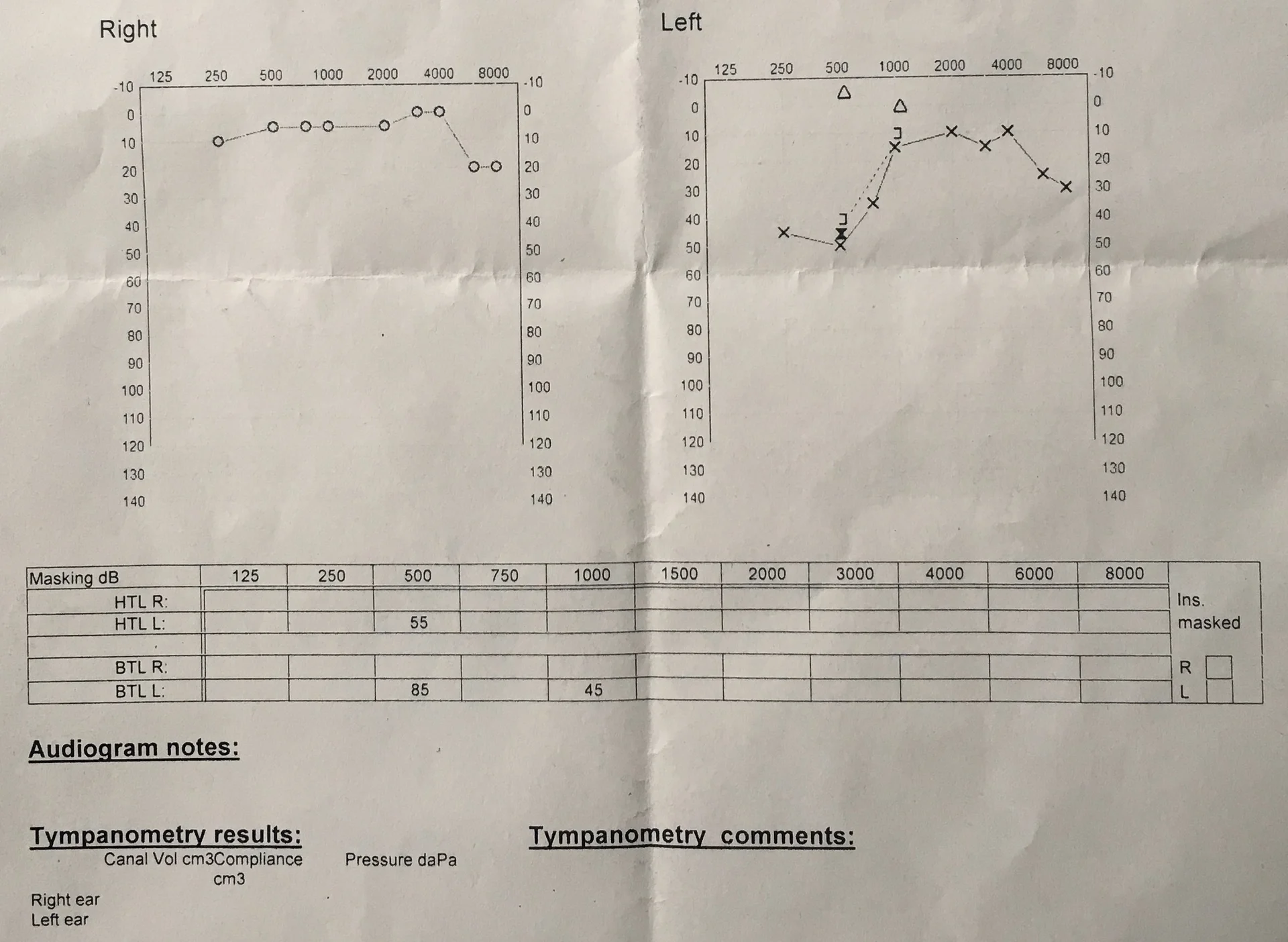 Audiogram hearing test copy