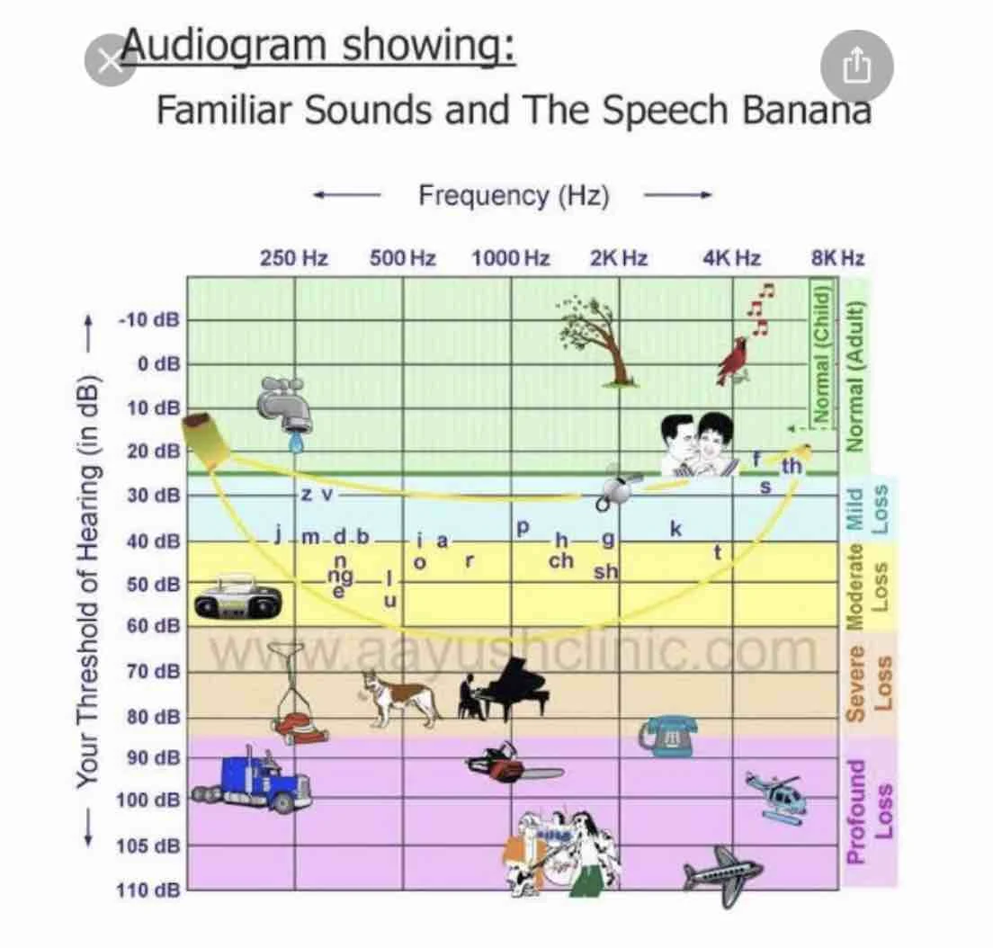 Hearing Loss chart