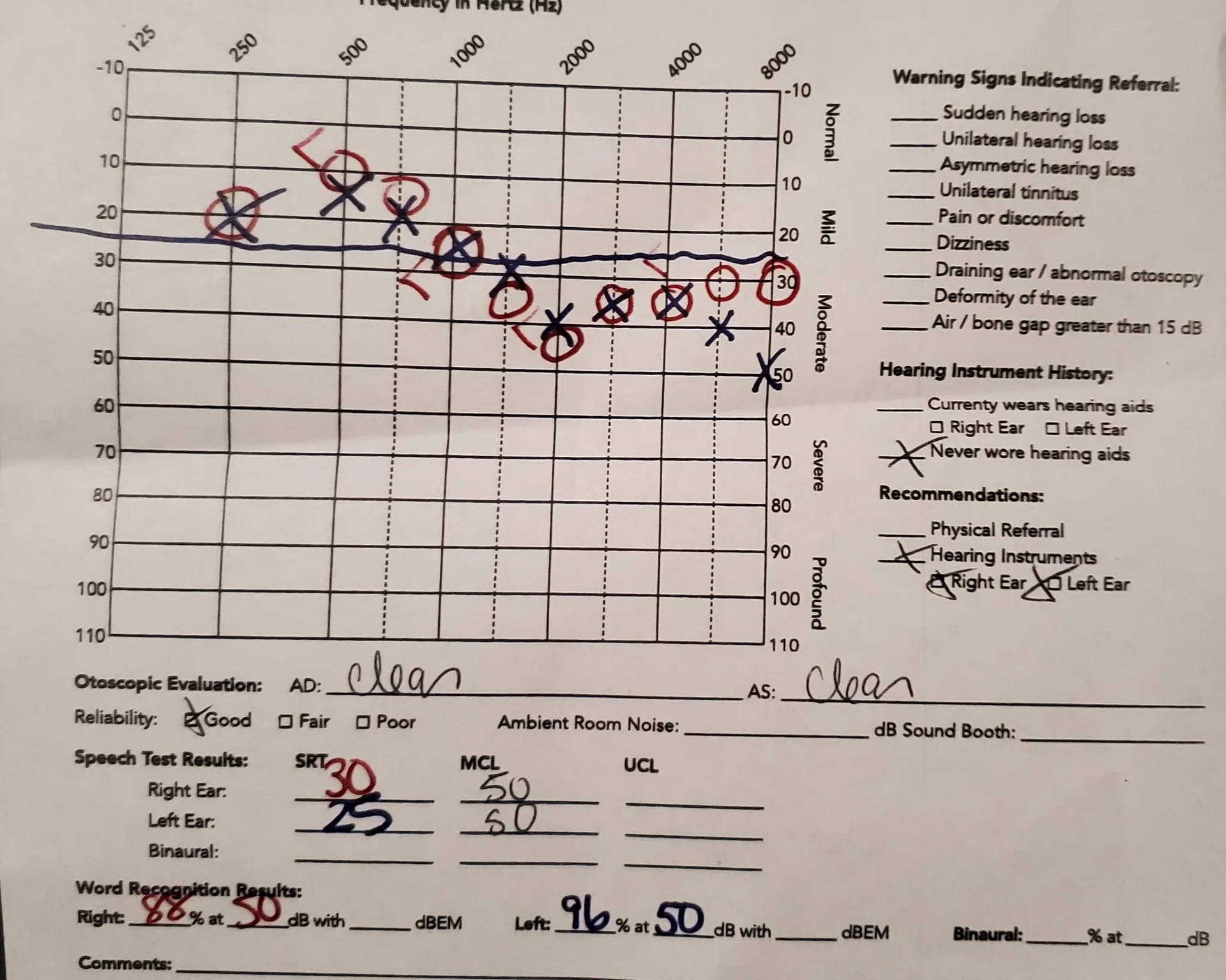 Hearing Test Resuts Small