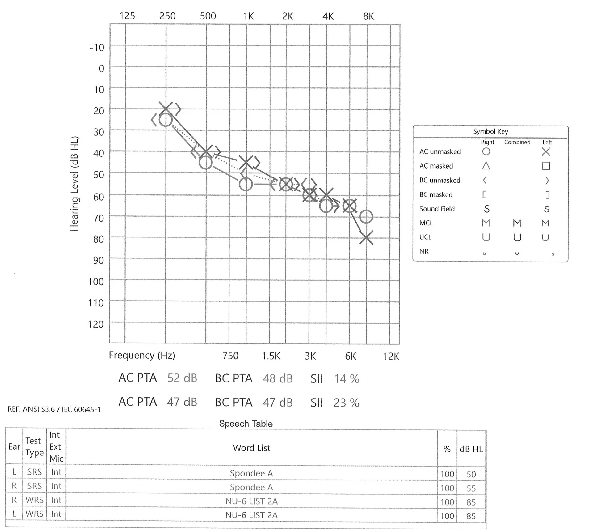 Audiogram 2023.10.26 cropped