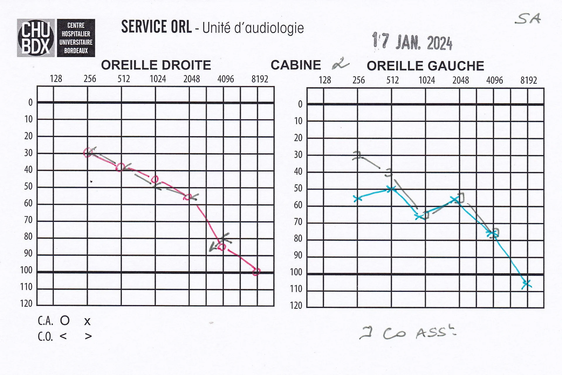 audiogramme