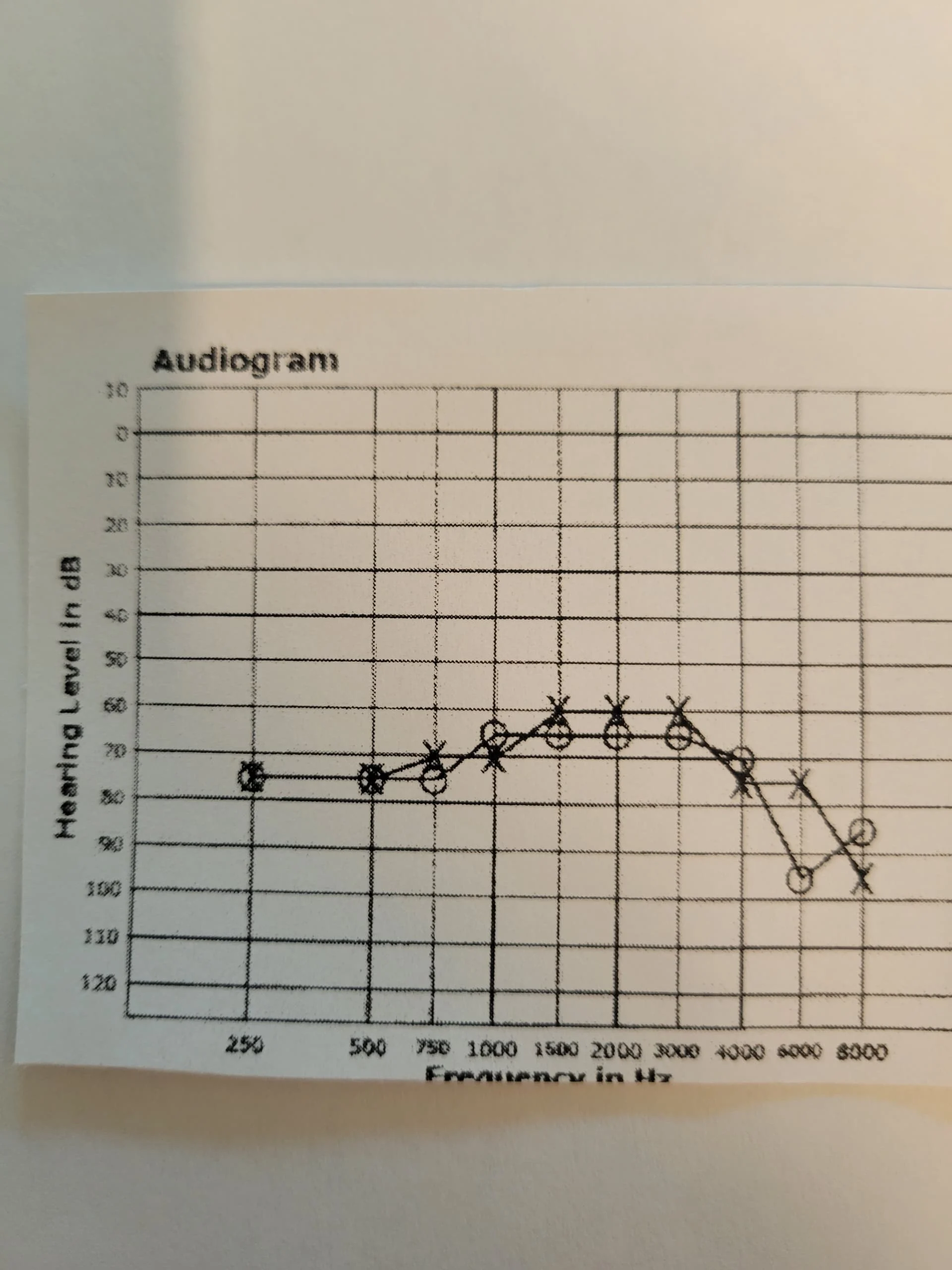 !audiogram only 9-16-2024