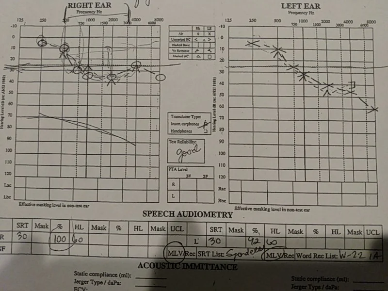 Audiogram3