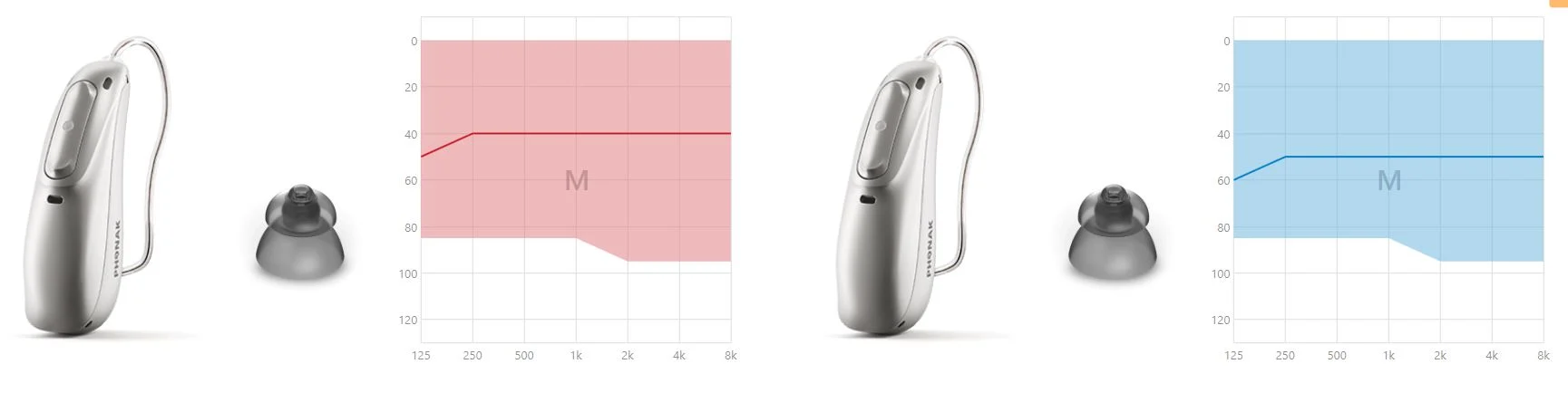 FlaLineAudiogram
