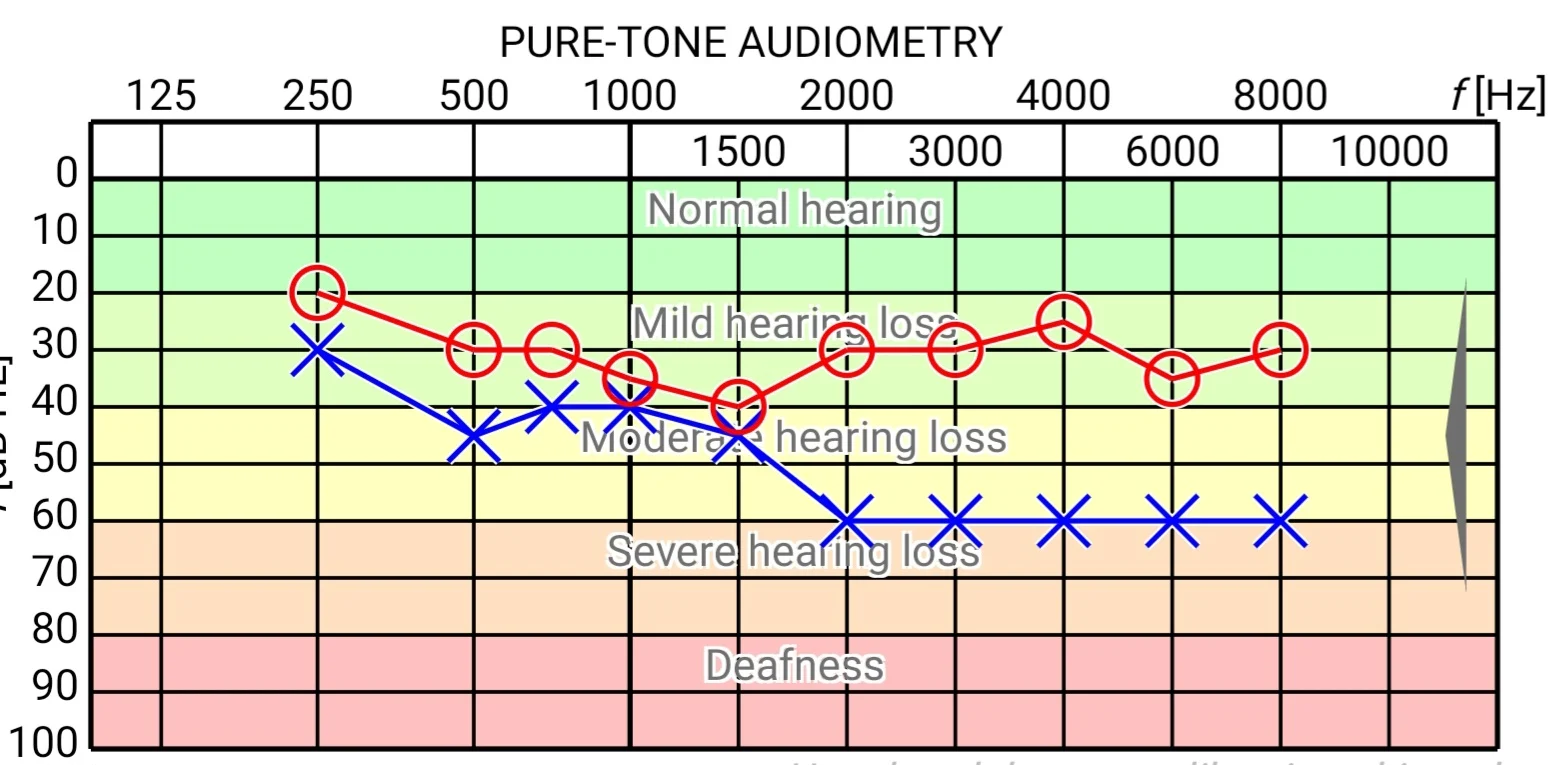 Screenshot_20230328_063837_Hearing Test